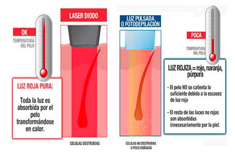 Retirarse Colibrí Negar Tecnología Diodo Láser de Alta Pontencia | Depilacion Laser ...